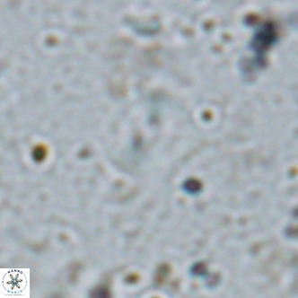 Watznaueria bayackii VR 16195