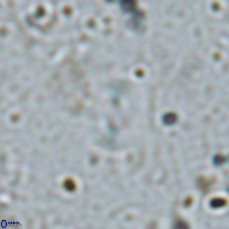 Watznaueria bayackii VR 16196