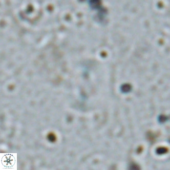 Watznaueria bayackii VR 16196