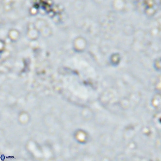 Watznaueria bayackii VR 16198