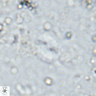Watznaueria bayackii VR 16198