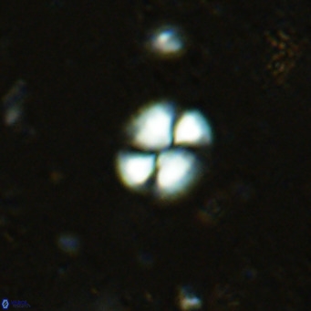 Watznaueria bayackii VR 16199