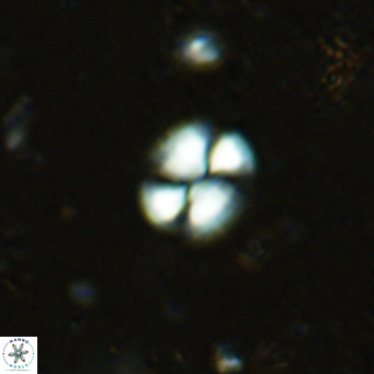Watznaueria bayackii VR 16199