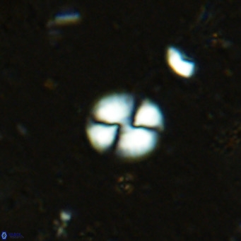 Watznaueria bayackii VR 16201