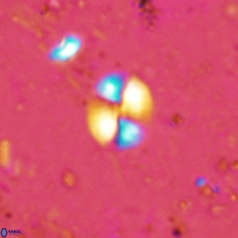 Watznaueria bayackii VR 16205
