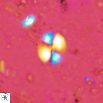Watznaueria bayackii VR 16205