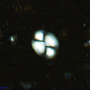 Watznaueria bayackii VR 16206