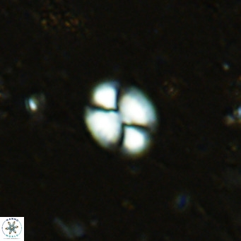 Watznaueria bayackii VR 16206