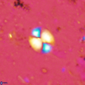 Watznaueria bayackii VR 16207