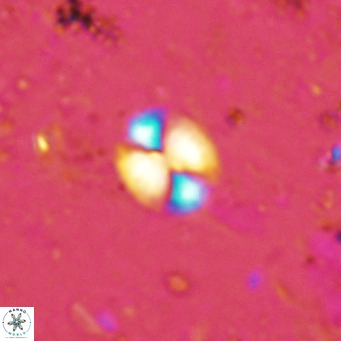 Watznaueria bayackii VR 16207