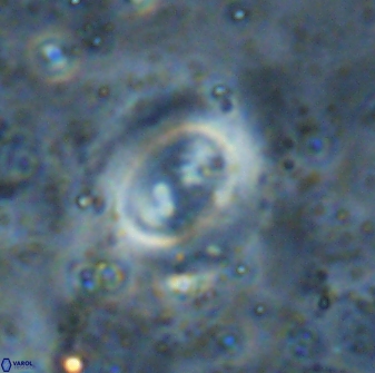 Watznaueria biporta 14731