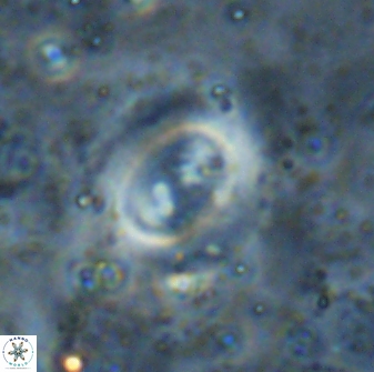 Watznaueria biporta 14731