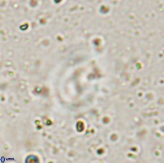 Watznaueria biporta 14732