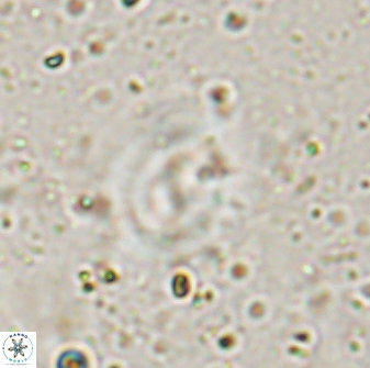 Watznaueria biporta 14732