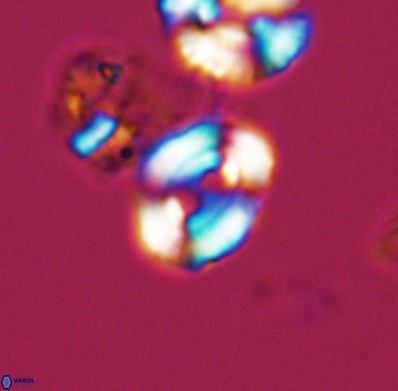 Watznaueria biporta 11625
