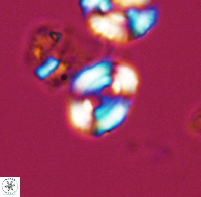 Watznaueria biporta 11625