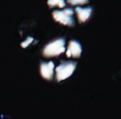Watznaueria biporta 11626