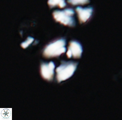 Watznaueria biporta 11626