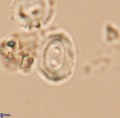 Watznaueria biporta 11627