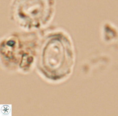 Watznaueria biporta 11627