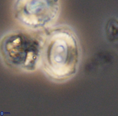 Watznaueria biporta 11628