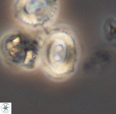 Watznaueria biporta 11628