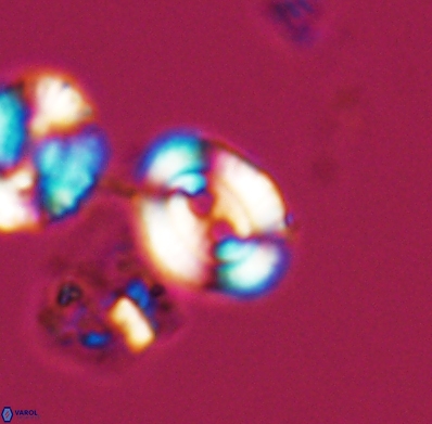 Watznaueria biporta 11620