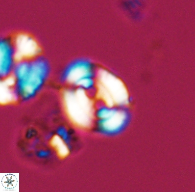Watznaueria biporta 11620