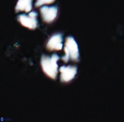 Watznaueria biporta 11622