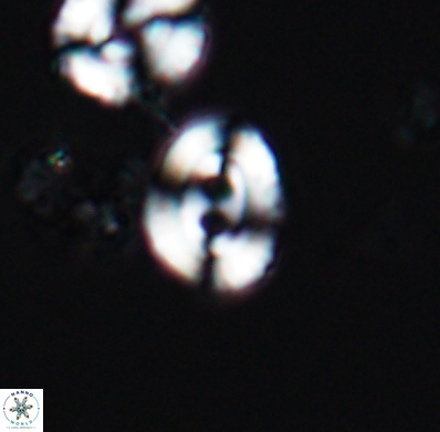 Watznaueria biporta 11622