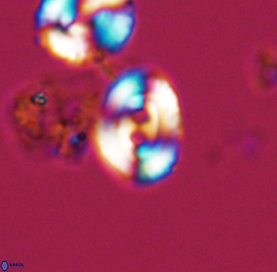 Watznaueria biporta 11623