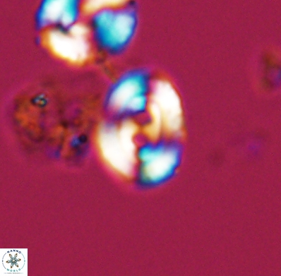 Watznaueria biporta 11623