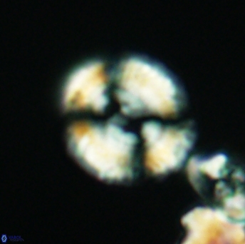 Watznaueria biporta 2629