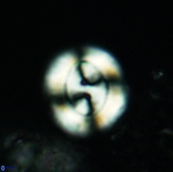 Watznaueria biporta 3557