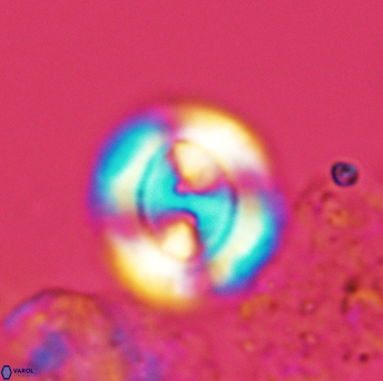 Watznaueria biporta 3558