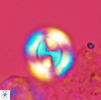 Watznaueria biporta 3558