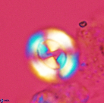 Watznaueria biporta 3559