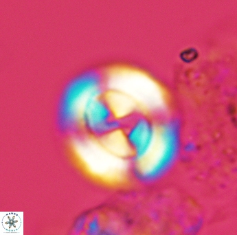Watznaueria biporta 3559