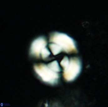 Watznaueria biporta 3560