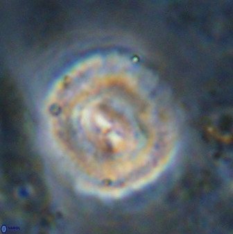 Watznaueria cauveryensis 36327