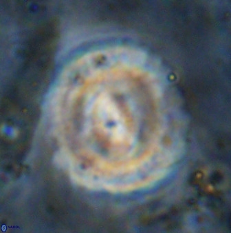 Watznaueria cauveryensis 36329