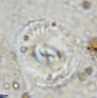 Watznaueria cauveryensis 36332