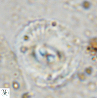 Watznaueria cauveryensis 36332