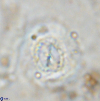 Watznaueria cauveryensis 36334