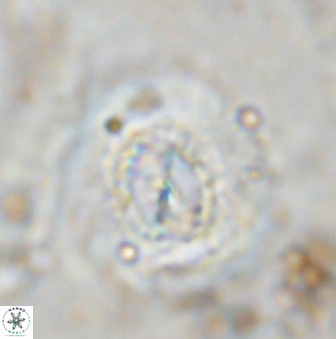 Watznaueria cauveryensis 36334