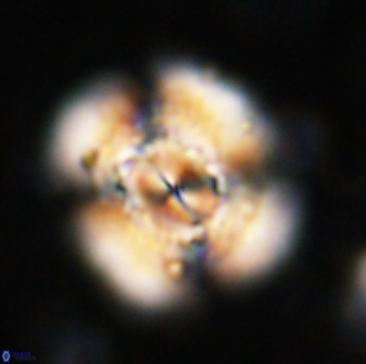 Watznaueria cauveryensis 36339