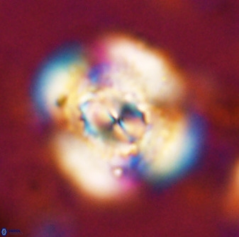 Watznaueria cauveryensis 36340