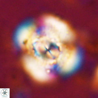 Watznaueria cauveryensis 36340