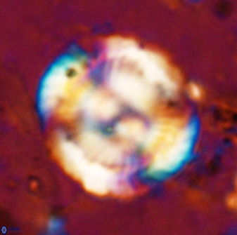Watznaueria cauveryensis 36341