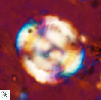 Watznaueria cauveryensis 36341